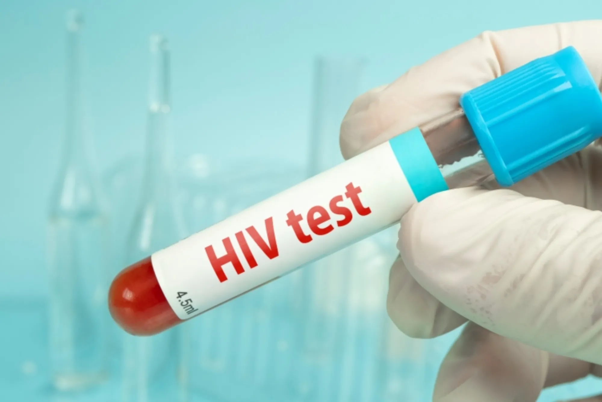 Everything You Need to Know About HIV Blood Test